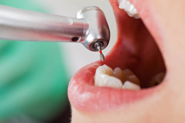 Best Emergency Treatment for Oral Infections in Oneida, TN